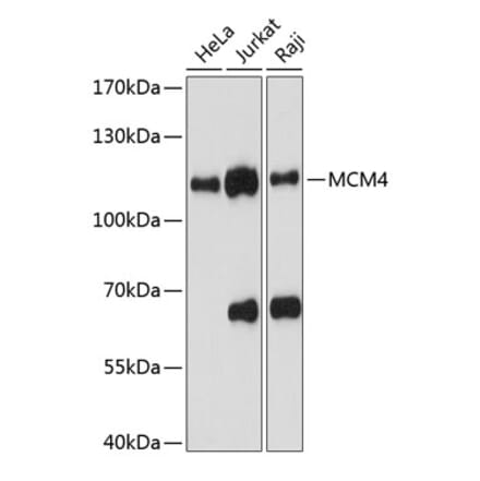 Western Blot - Anti-MCM4 Antibody (A87834) - Antibodies.com