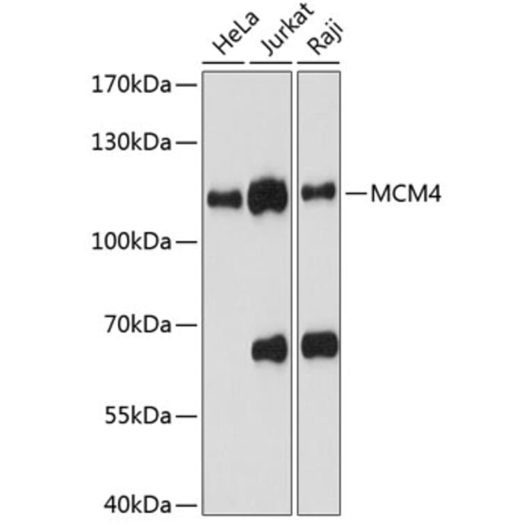 Western Blot - Anti-MCM4 Antibody (A87834) - Antibodies.com
