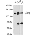 Western Blot - Anti-MCM4 Antibody (A87834) - Antibodies.com