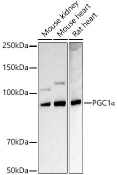 Western blot analysis of extracts of various cell lines, using Anti-PPARGC1A Antibody (A11971) at 1:1,000 dilution.
Secondary antibody: Goat Anti-Rabbit IgG (H+L) (HRP) (AS014) at 1:10,000 dilution.
Lysates / proteins: 25µg per lane.
Blocking buffer: 3% non-fat dry milk in TBST.
Detection: ECL Basic Kit (RM00020).
Exposure time: 15s.