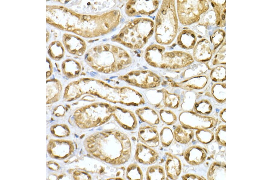 Immunohistochemistry - Anti-PGC1 alpha Antibody (A87835) - Antibodies.com