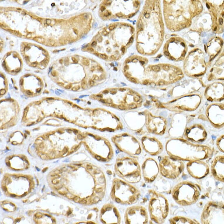 Immunohistochemistry - Anti-PGC1 alpha Antibody (A87835) - Antibodies.com