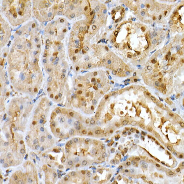 Immunohistochemistry - Anti-PGC1 alpha Antibody (A87835) - Antibodies.com