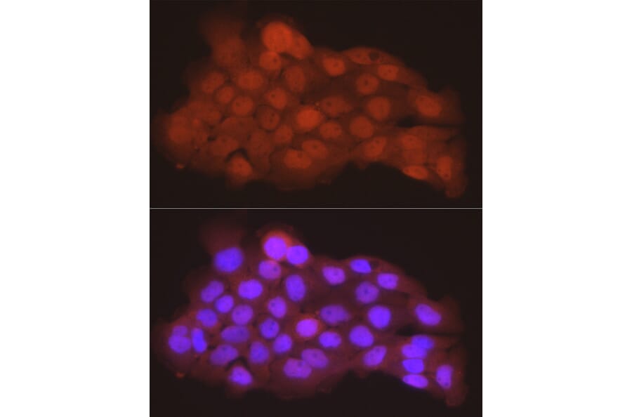Immunofluorescence - Anti-PGC1 alpha Antibody (A87835) - Antibodies.com