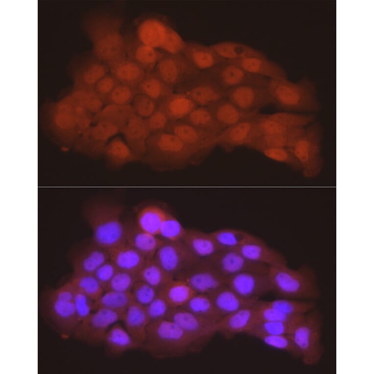 Immunofluorescence - Anti-PGC1 alpha Antibody (A87835) - Antibodies.com