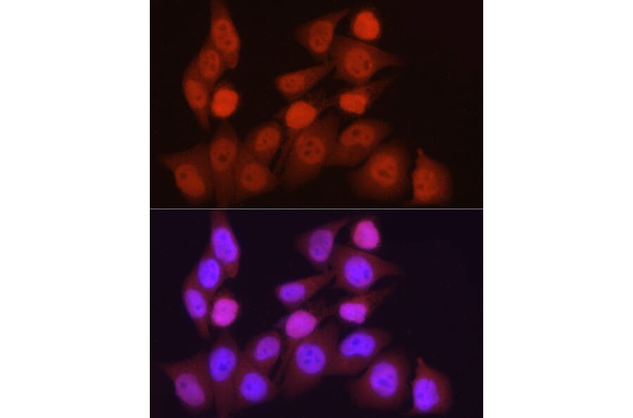 Immunofluorescence - Anti-PGC1 alpha Antibody (A87835) - Antibodies.com