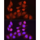 Immunofluorescence - Anti-PGC1 alpha Antibody (A87835) - Antibodies.com