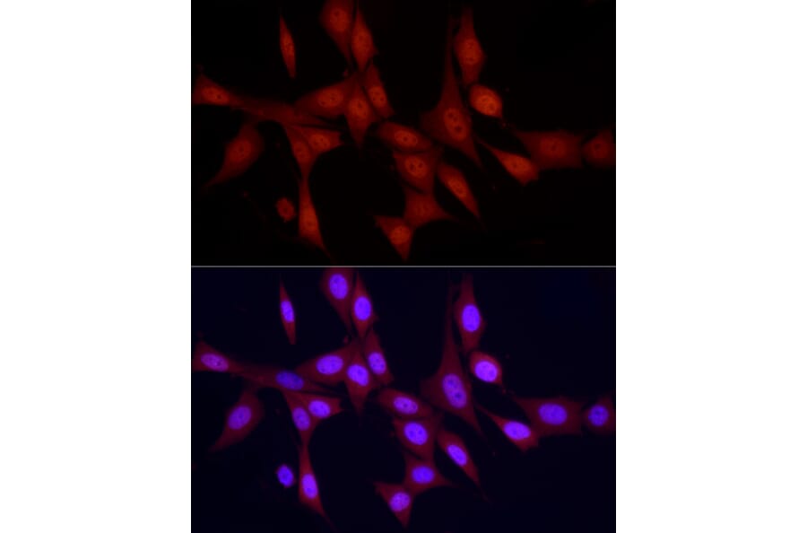 Immunofluorescence - Anti-PGC1 alpha Antibody (A87835) - Antibodies.com