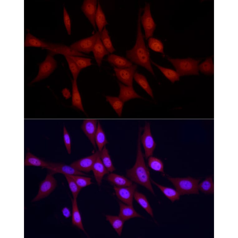 Immunofluorescence - Anti-PGC1 alpha Antibody (A87835) - Antibodies.com