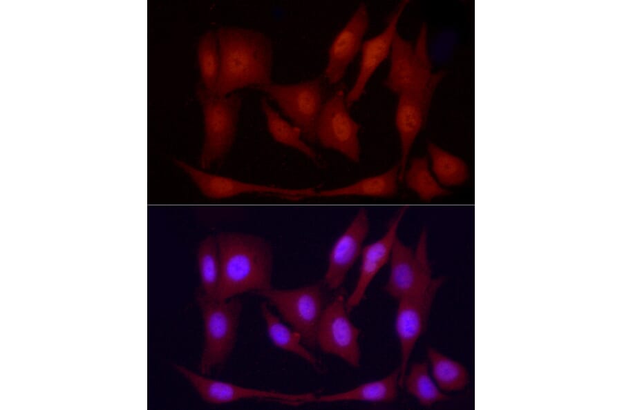 Immunofluorescence - Anti-PGC1 alpha Antibody (A87835) - Antibodies.com