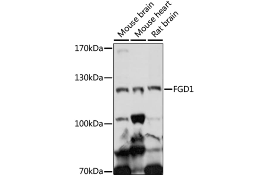 Western Blot - Anti-FGD1 Antibody (A87836) - Antibodies.com