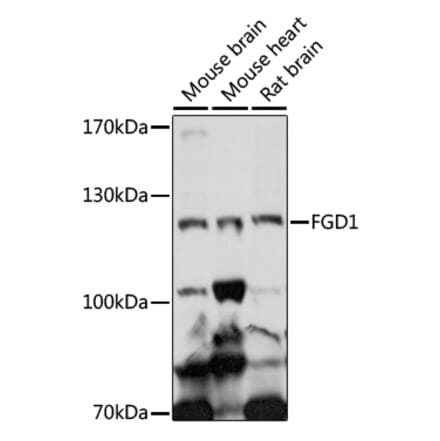 Western Blot - Anti-FGD1 Antibody (A87836) - Antibodies.com