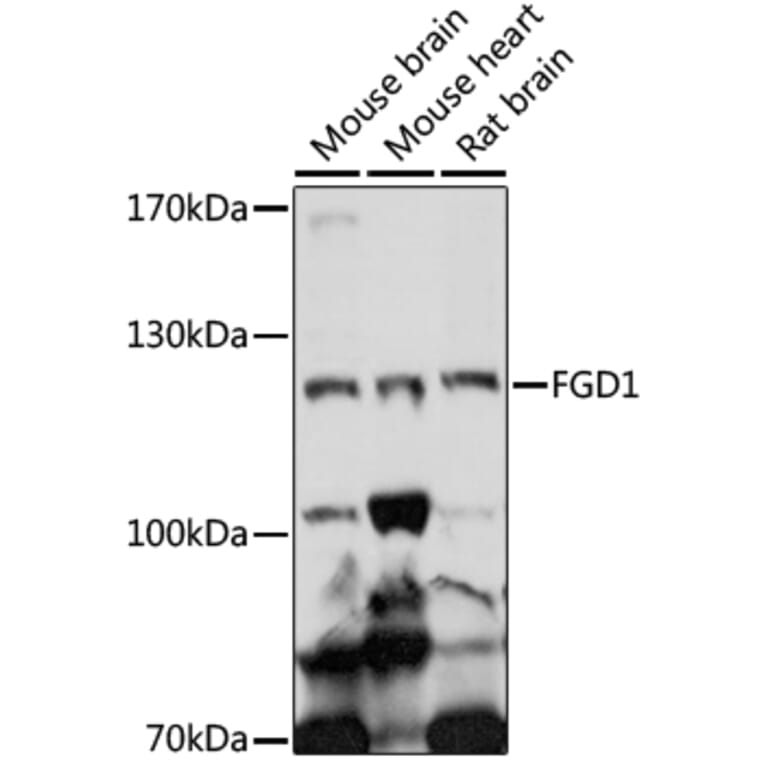 Western Blot - Anti-FGD1 Antibody (A87836) - Antibodies.com