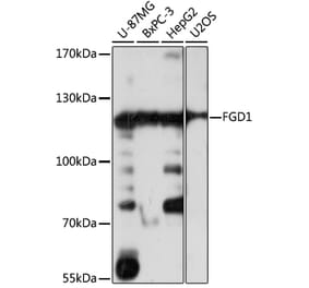 Western Blot - Anti-FGD1 Antibody (A87837) - Antibodies.com