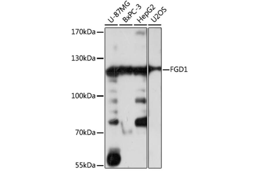 Western Blot - Anti-FGD1 Antibody (A87837) - Antibodies.com