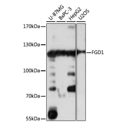 Western Blot - Anti-FGD1 Antibody (A87837) - Antibodies.com