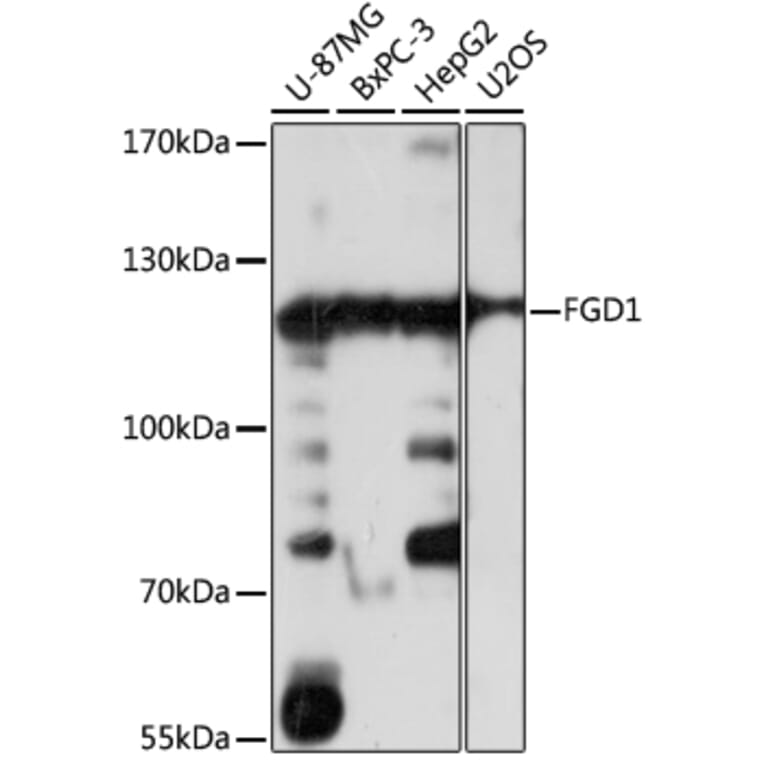 Western Blot - Anti-FGD1 Antibody (A87837) - Antibodies.com