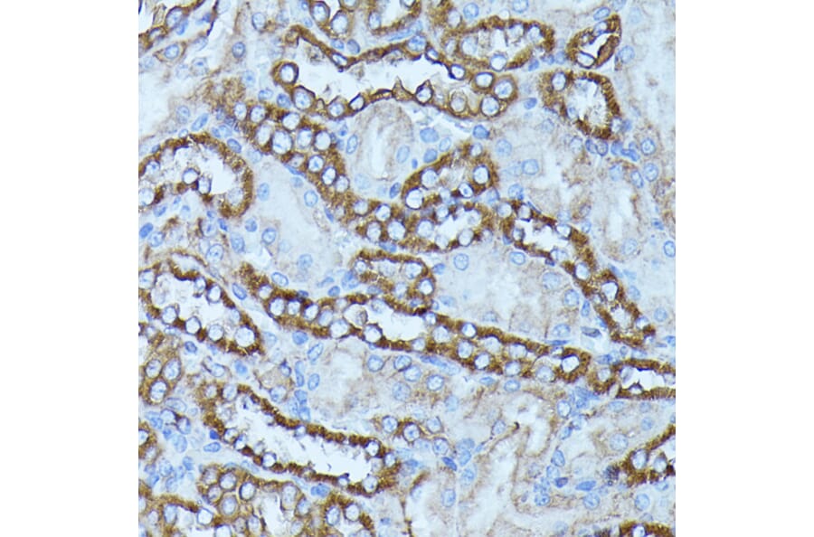 Immunohistochemistry - Anti-FGD1 Antibody (A87837) - Antibodies.com