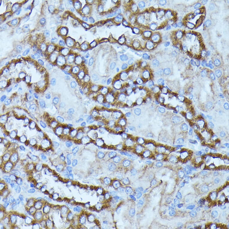 Immunohistochemistry - Anti-FGD1 Antibody (A87837) - Antibodies.com