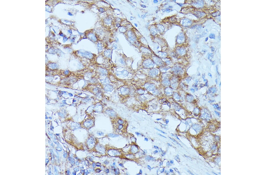 Immunohistochemistry - Anti-FGD1 Antibody (A87837) - Antibodies.com