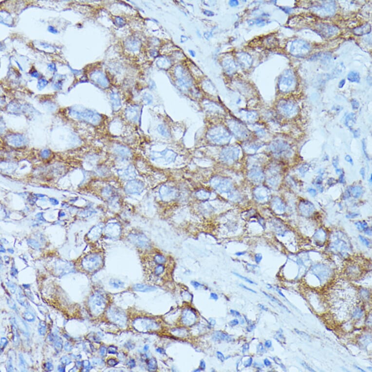 Immunohistochemistry - Anti-FGD1 Antibody (A87837) - Antibodies.com