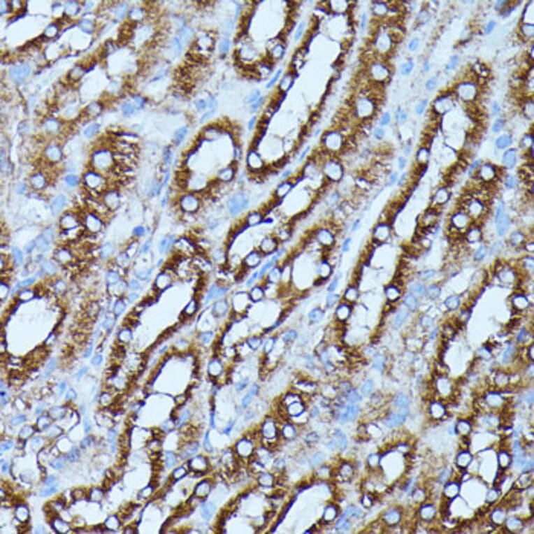 Immunohistochemistry - Anti-FGD1 Antibody (A87837) - Antibodies.com