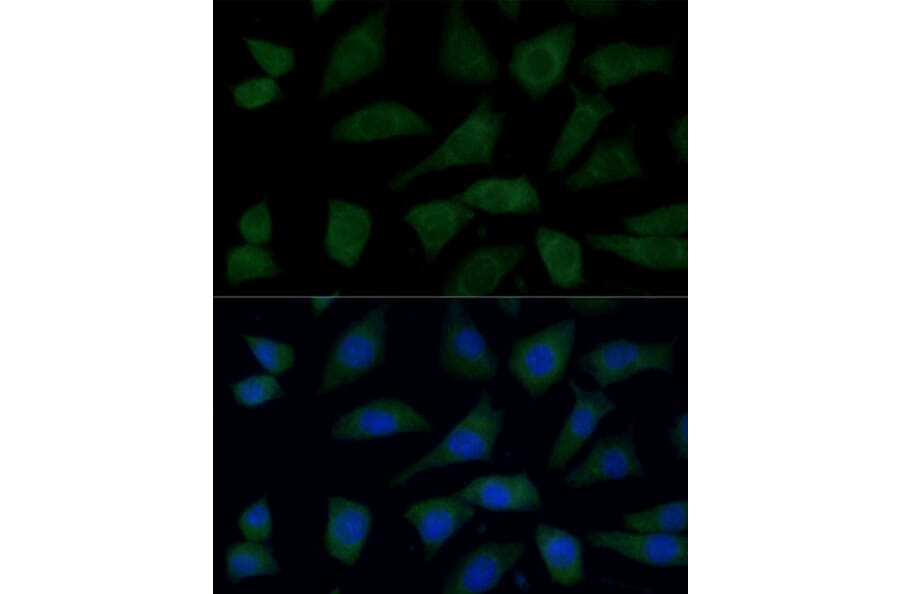 Immunofluorescence - Anti-FGD1 Antibody (A87837) - Antibodies.com