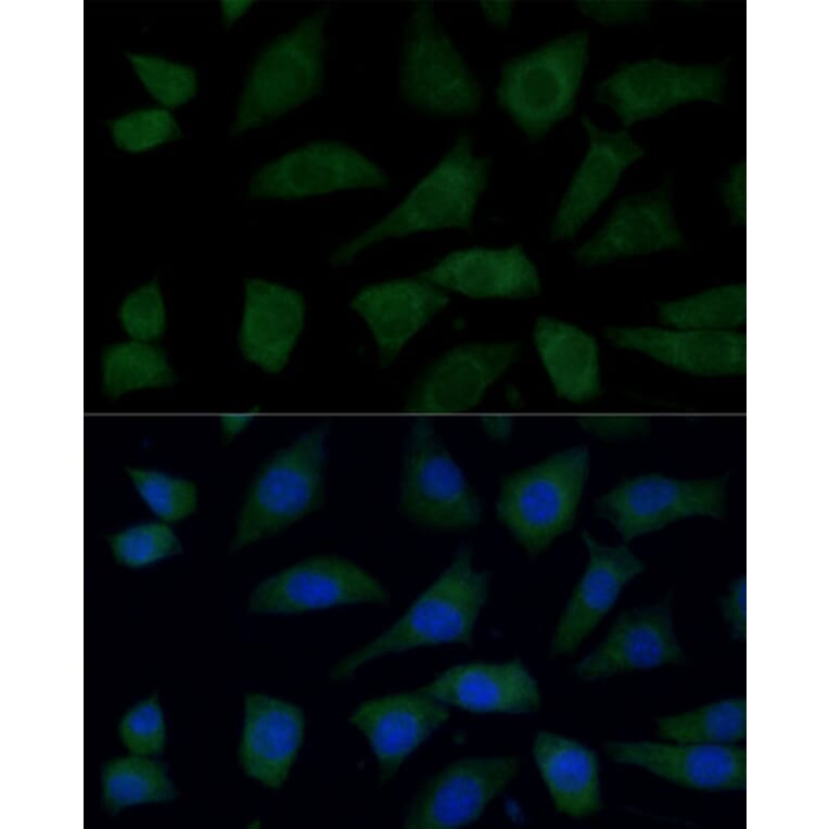 Immunofluorescence - Anti-FGD1 Antibody (A87837) - Antibodies.com