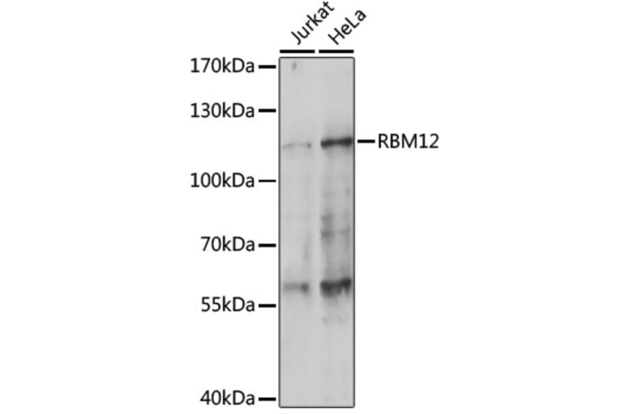 Western Blot - Anti-SWAN Antibody (A87838) - Antibodies.com