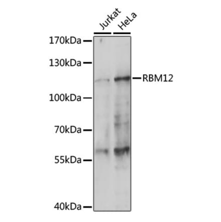 Western Blot - Anti-SWAN Antibody (A87838) - Antibodies.com