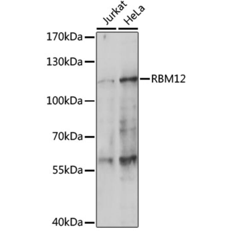 Western Blot - Anti-SWAN Antibody (A87838) - Antibodies.com