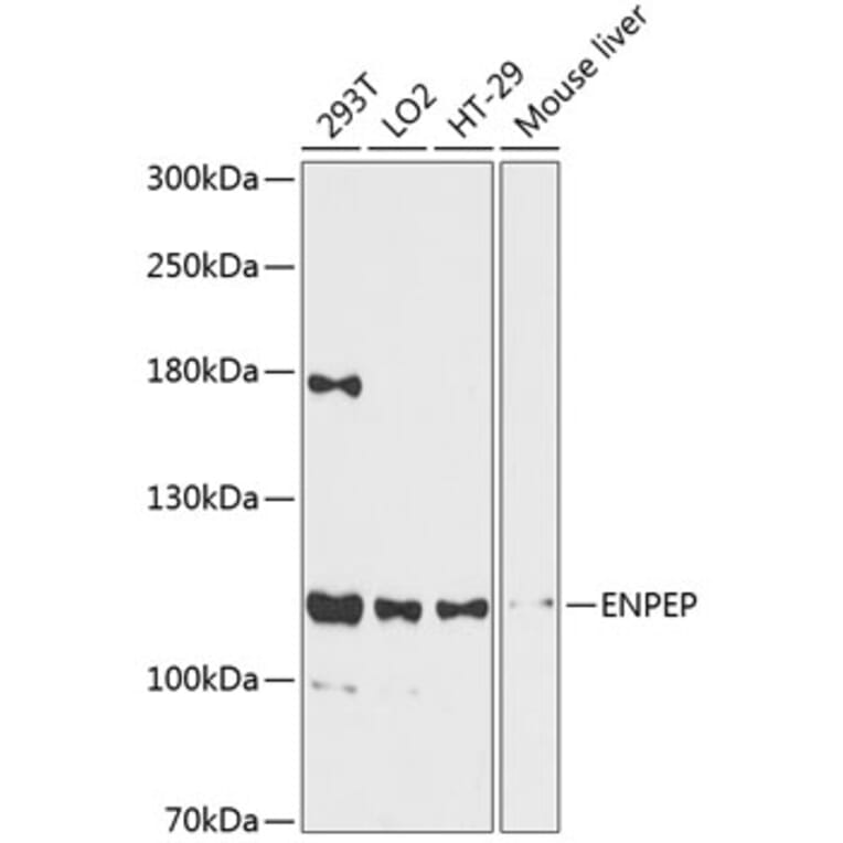 Western Blot - Anti-ENPEP Antibody (A87839) - Antibodies.com