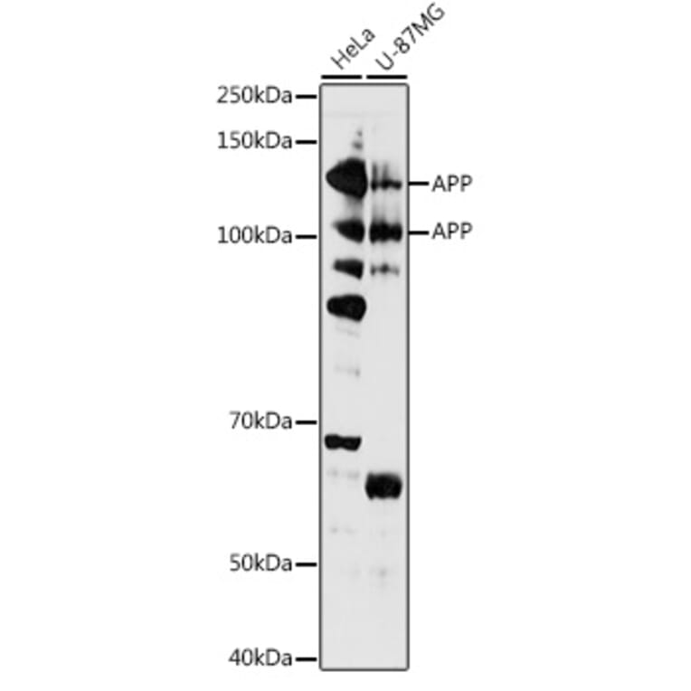Western Blot - Anti-Amyloid Precursor Protein Antibody (A87840) - Antibodies.com