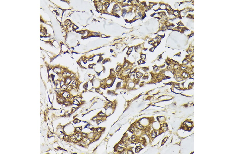 Immunohistochemistry - Anti-PI 3 Kinase catalytic subunit alpha / PIK3CA Antibody (A87841) - Antibodies.com