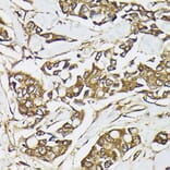 Immunohistochemistry - Anti-PI 3 Kinase catalytic subunit alpha / PIK3CA Antibody (A87841) - Antibodies.com