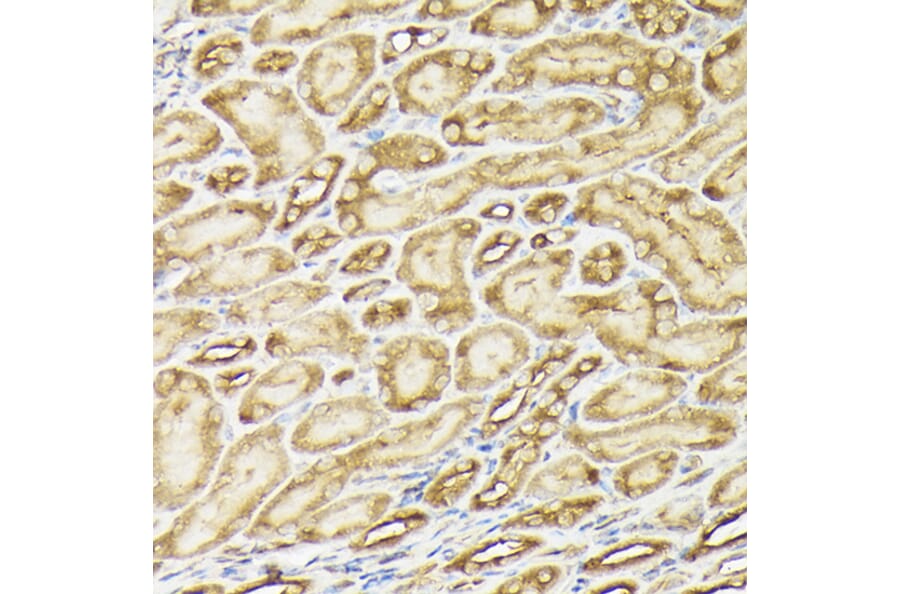 Immunohistochemistry - Anti-PI 3 Kinase catalytic subunit alpha / PIK3CA Antibody (A87841) - Antibodies.com