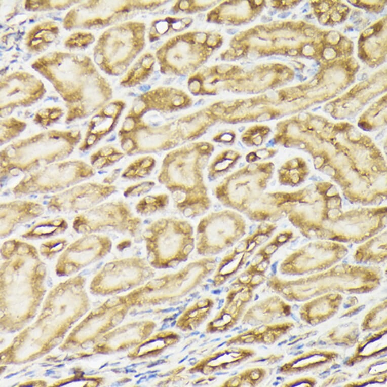 Immunohistochemistry - Anti-PI 3 Kinase catalytic subunit alpha / PIK3CA Antibody (A87841) - Antibodies.com