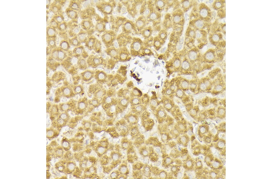 Immunohistochemistry - Anti-PI 3 Kinase catalytic subunit alpha / PIK3CA Antibody (A87841) - Antibodies.com