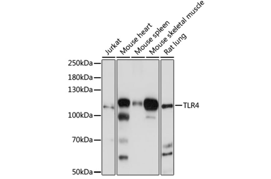 Western Blot - Anti-TLR4 Antibody (A17436) - Antibodies.com