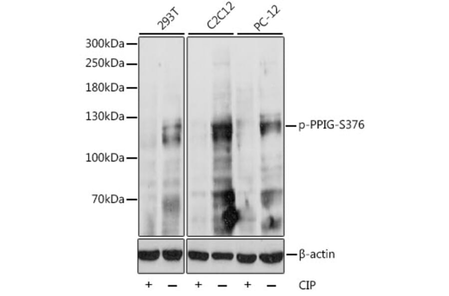 Western Blot - Anti-PPIG (phospho Ser376) Antibody (A87843) - Antibodies.com