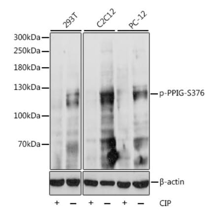Western Blot - Anti-PPIG (phospho Ser376) Antibody (A87843) - Antibodies.com