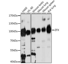 Western Blot - Anti-Zfx Antibody (A87846) - Antibodies.com