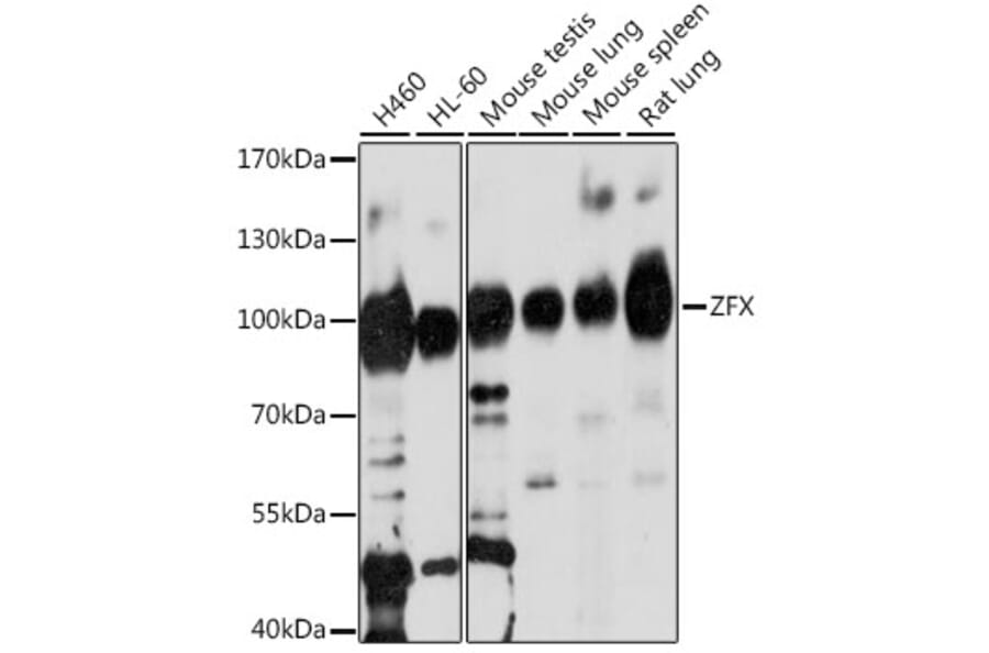 Western Blot - Anti-Zfx Antibody (A87846) - Antibodies.com