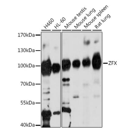 Western Blot - Anti-Zfx Antibody (A87846) - Antibodies.com