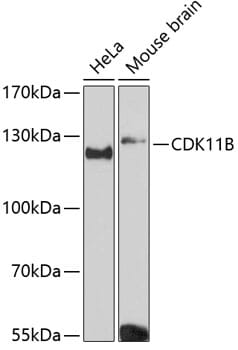 Western blot analysis of extracts of various cell lines, using Anti-CDK11B Antibody (A12830) at 1:3000 dilution.
Secondary antibody: Goat Anti-Rabbit IgG (H+L) (HRP) (AS014) at 1:10,000 dilution.
Lysates / proteins: 25µg per lane.
Blocking buffer: 3% non-fat dry milk in TBST.
Detection: ECL Basic Kit (RM00020).
Exposure time: 90s.