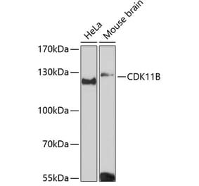 Western Blot - Anti-CDK11B Antibody (A87847) - Antibodies.com