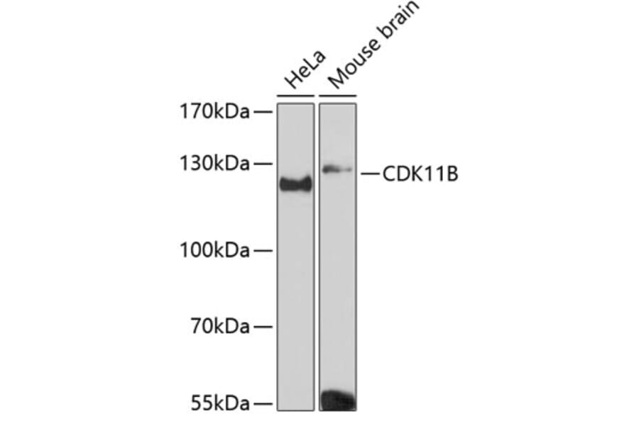 Western Blot - Anti-CDK11B Antibody (A87847) - Antibodies.com
