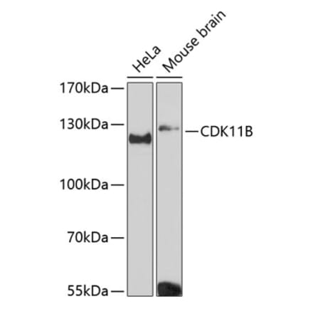 Western Blot - Anti-CDK11B Antibody (A87847) - Antibodies.com