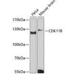 Western Blot - Anti-CDK11B Antibody (A87847) - Antibodies.com