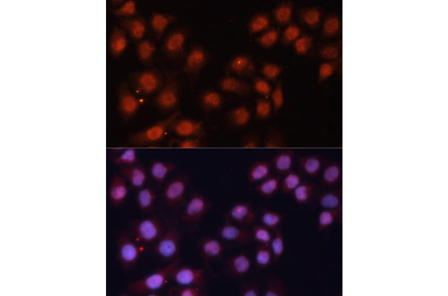 Immunofluorescence - Anti-CDK11B Antibody (A87847) - Antibodies.com